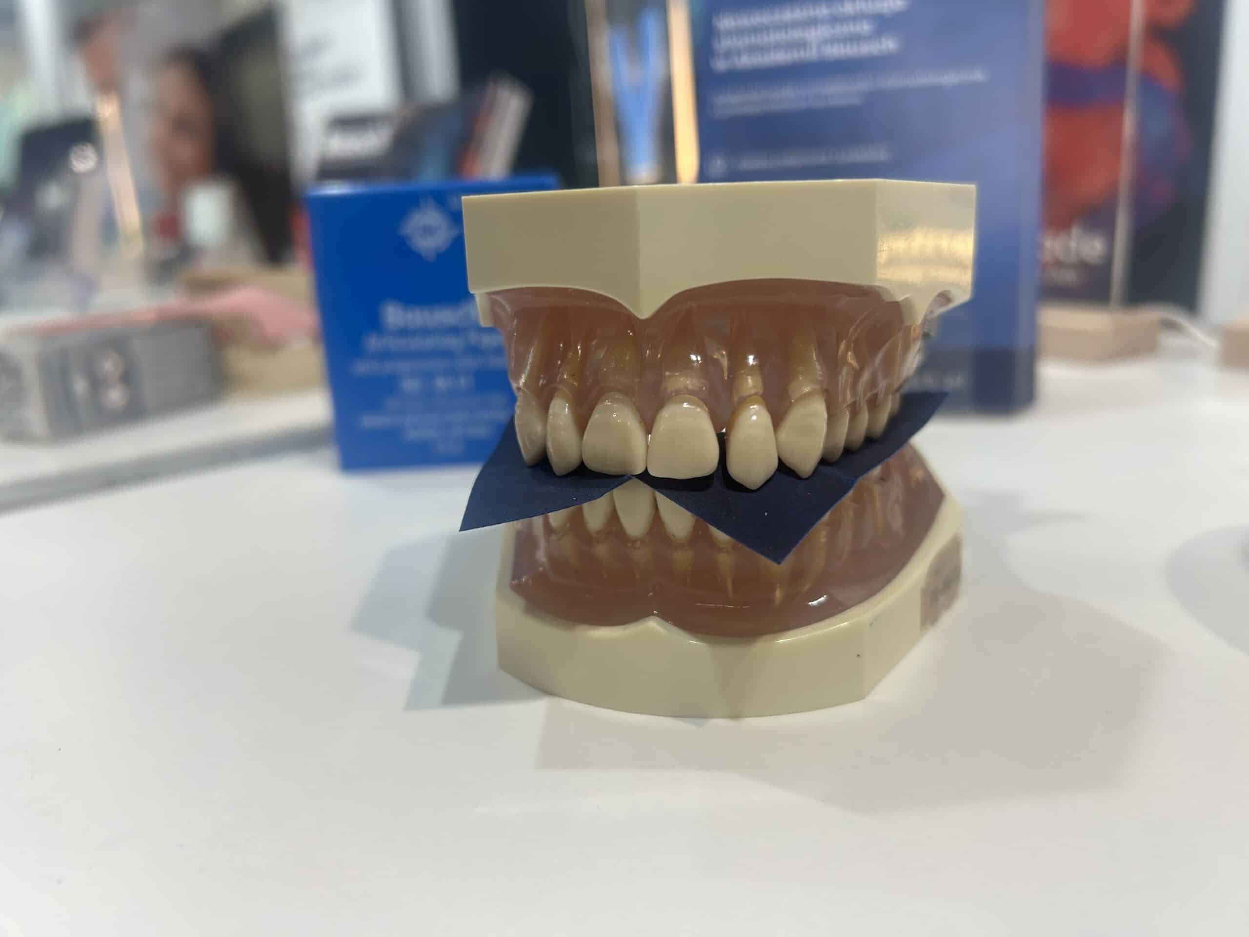 Blog o okluzji - artykuły o okluzji: 5 najczęstszych błędów w ocenie kontaktów zwarciowych – jak ich unikać?